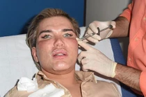 Cận cảnh 3 tiếng tiêm botox của búp bê sống Ken Doll