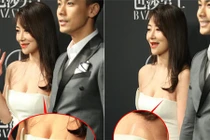 Sao Hoa ngữ kém xinh vì lộ miếng dán ngực