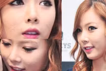 10 sao Hàn khổ sở vì mụn “tấn công” gương mặt