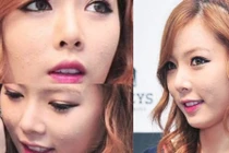 10 sao Hàn khổ sở vì mụn “tấn công” gương mặt