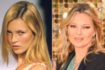 Những sao Hollywood trẻ mãi nhờ phẫu thuật thẩm mỹ