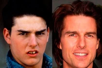 Sao đẹp lên nhờ tút lại “bộ nhá’