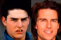 Sao đẹp lên nhờ tút lại “bộ nhá’