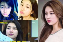 Suzy bị “tố” phẫu thuật thẩm mỹ nhiều lần