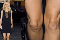 Phát hoảng với những đôi chân củ lạc cực xấu của sao