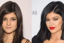 10 sao Hollywood tốn tiền tỷ cho phẫu thuật thẩm mỹ