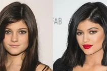 10 sao Hollywood tốn tiền tỷ cho phẫu thuật thẩm mỹ