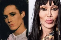 Ca sĩ Anh quốc qua đời sau 300 cuộc phẫu thuật thẩm mỹ