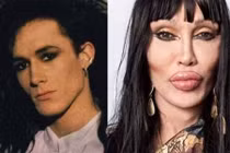 Ca sĩ Anh quốc qua đời sau 300 cuộc phẫu thuật thẩm mỹ