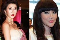 Sao Việt khác lạ vì làm đẹp bằng dao kéo 