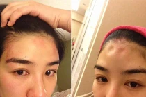 Huỳnh Dịch đệ đơn ly hôn, cáo buộc chồng đánh đập