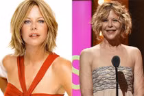 Phát hoảng với mặt cứng đờ, biến dạng của sao Hollywood vì Botox