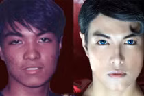 18 năm phẫu thuật thẩm mỹ để giống Superman