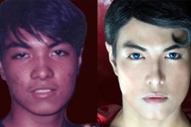 18 năm phẫu thuật thẩm mỹ để giống Superman