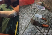 Hàng chục thanh niên truy sát người bán hàng rong