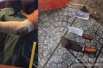 Hàng chục thanh niên truy sát người bán hàng rong