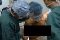 Người mẫu Trung Quốc phát trực tiếp cảnh nâng ngực gây sốc