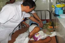 Nỗi ân hận người mẹ đẩy con vào lửa đến nguy kịch