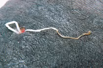 Kinh hãi cảnh giun ký sinh bị kéo ra khỏi chân người