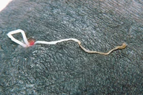 Kinh hãi cảnh giun ký sinh bị kéo ra khỏi chân người