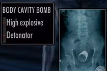 Khủng bố dùng chiêu gì mang vũ khí lên máy bay?