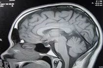 Những quan niệm khoa học tưởng “trên trời” hóa đúng (1)