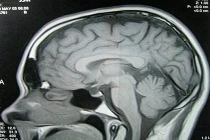 Những quan niệm khoa học tưởng “trên trời” hóa đúng (1)