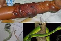 Nọc độc rắn lục đuôi đỏ nguy hiểm cỡ nào?