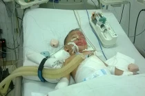 Hai trẻ đuối nước bị bỏ vào lu rồi hơ trên lửa