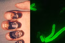 Tận mục vi khuẩn gây ra Cái chết Đen