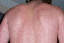 Những con số giật mình từ biến đổi khí hậu