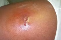 Tận mục siêu vi khuẩn đáng sợ đang xâm lấn nhà dân