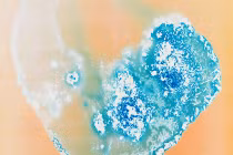 Ma túy có hình dáng thế nào dưới kính hiển vi 