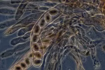 Xem nấm biến hình kỳ quái dưới kính hiển vi 