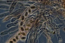 Xem nấm biến hình kỳ quái dưới kính hiển vi 