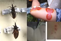Tận mục loài bọ xít hút máu tấn công người ở Hà Nội