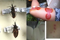 Tận mục loài bọ xít hút máu tấn công người ở Hà Nội