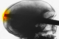 Hoảng hồn với những bản chụp X-quang đáng sợ