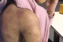 Hà Nội yêu cầu gì về vụ bạo hành trẻ em, nghi bị xâm hại tại quận Hà Đông?