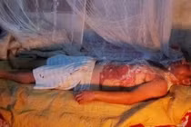 Nghệ An: Mâu thuẫn, vợ tưới nước sôi lên người chồng 