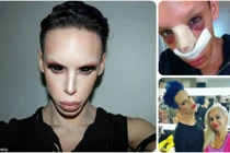 Kỳ quái: Chi 1 tỉ để phẫu thuật thành...người ngoài hành tinh