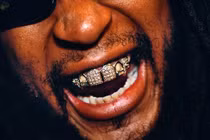 Nhà giàu đeo dây chuyền 15kg vàng, bọc răng kim cương tiền tỷ