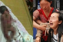 Chỉ vì quên rút dây sạc điện thoại, con yêu gánh chịu hậu quả kinh hoàng