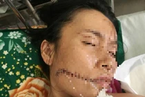 Uẩn khúc phía sau vụ người đàn ông phóng hỏa đốt nhân tình rồi tự thiêu