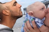 Bí ẩn người không não vẫn sống khỏe mạnh, có chỉ số IQ cực cao