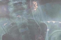 Thông tin mới nhất vụ bác sĩ mổ nhầm bệnh nhân tại Lâm Đồng 