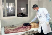 Người đàn ông tự cắt lìa dương vật do tiểu tiện khó khăn