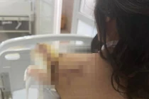 Công an đang bảo vệ người phụ nữ bị truy sát 2 lần