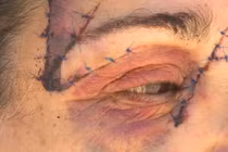 Khiếp đảm kangaroo tấn công người, may mắn chỉ phải khâu 25 mũi