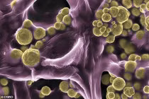 Kỳ bí loài nấm hút được vàng trong đất, ai vớ được giàu to